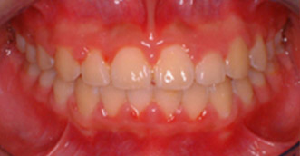 Before and after 6 Before and after 6
