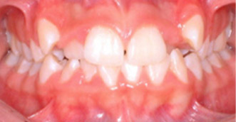 Before and after 3 Before and after 3