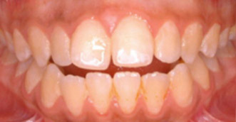 Before and after 4 Before and after 4