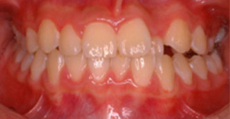 Before and after 6 Before and after 6