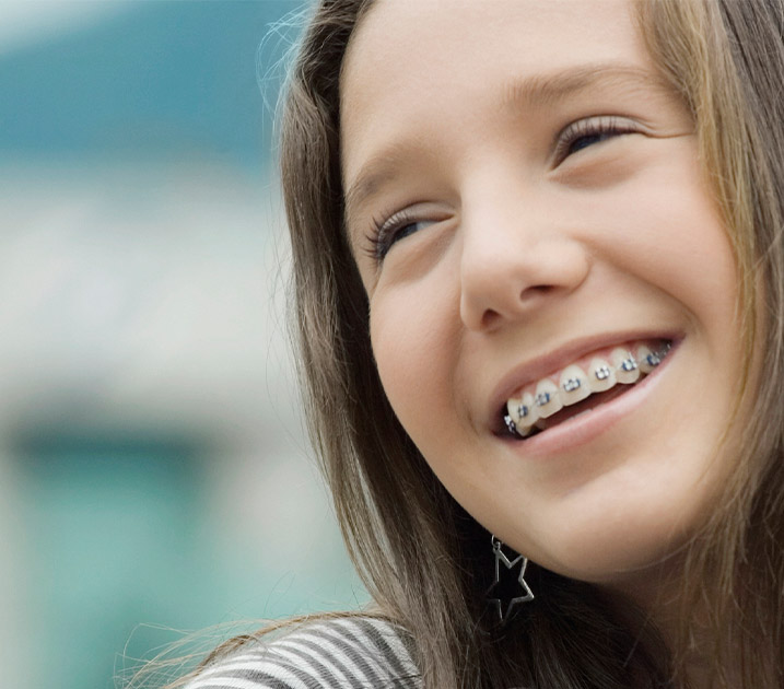 How do braces work? How do braces work?